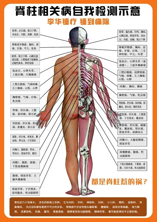 脊柱健康檢測示意圖,錘正療法