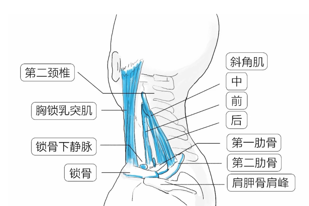 李華錘療,錘正療法,斜角肌